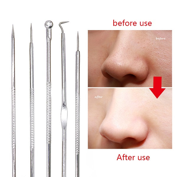 4Pcs/Set Rose Gold Acne Kit