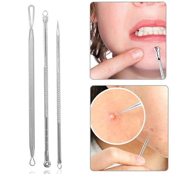 4Pcs/Set Rose Gold Acne Kit